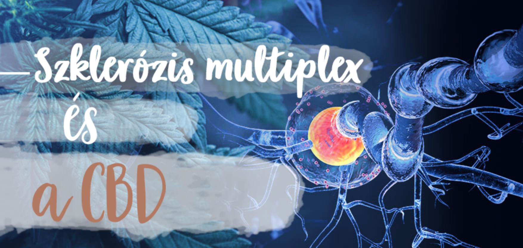 Sclerosis Multiplex ellen CBD olaj