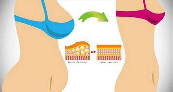 Hasi zsír eltüntetése könnyedén Hasi zsírpárna eltüntetése, fogyás hasról