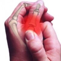 ízületi fájdalomcsillapítók don ár elektromos készülékek artrózis kezelésére