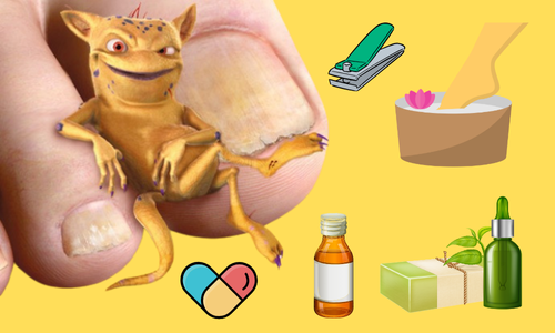 Körömgomba ellen házilag