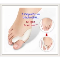 Valgus Pro-ról titkok nélkül