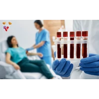 Vérvétel típusok: mi mindent mutathat meg a laborvizsgálat?
