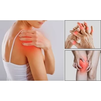 Ízületi gyulladás, ízületi fájdalom kezelése természetes gyógymódokkal