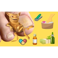 Körömgomba kezelése házilag - A legjobb természetes szerek körömgomba ellen 