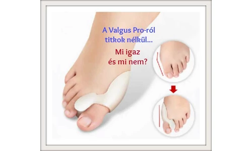 Valgus Pro-ról titkok nélkül
